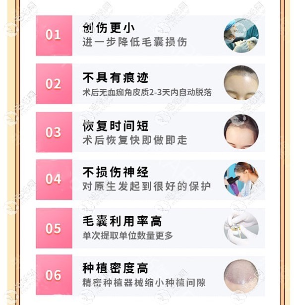 大连碧莲盛医院哪个医生发际线植发技术比较好？