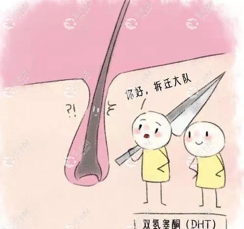 遺傳性m型發(fā)際線能植發(fā)