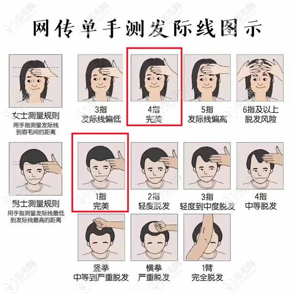 前額單手測量法