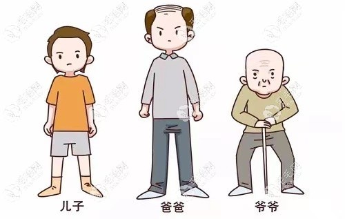 遺傳性m型發(fā)際線脫發(fā)