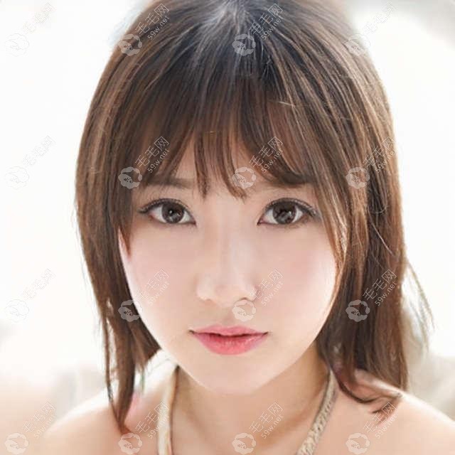 南京前額植發(fā)多少錢是參考種發(fā)際線比較好的醫(yī)院價格整合