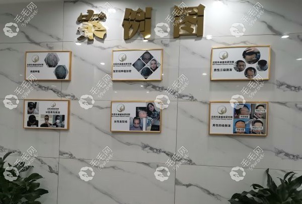 沈陽華美植發(fā)醫(yī)院案例墻