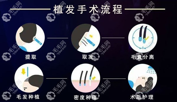 沈陽華美植發(fā)手術(shù)流程