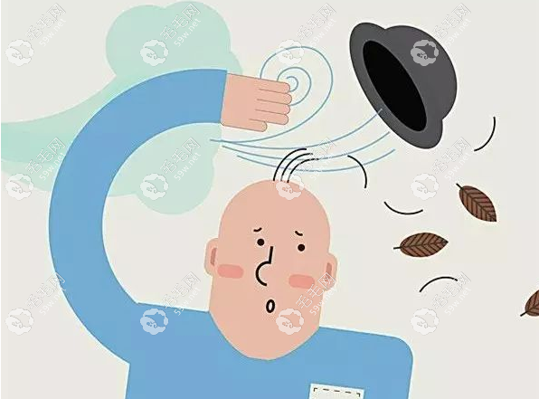 藥物性脫發(fā)大部分可以長回來