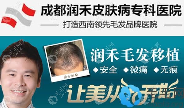 成都润禾毛发移植打造西南地区品牌