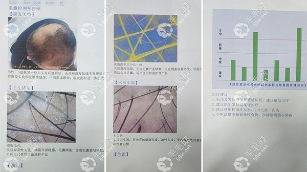 毛囊檢測報告59w.net