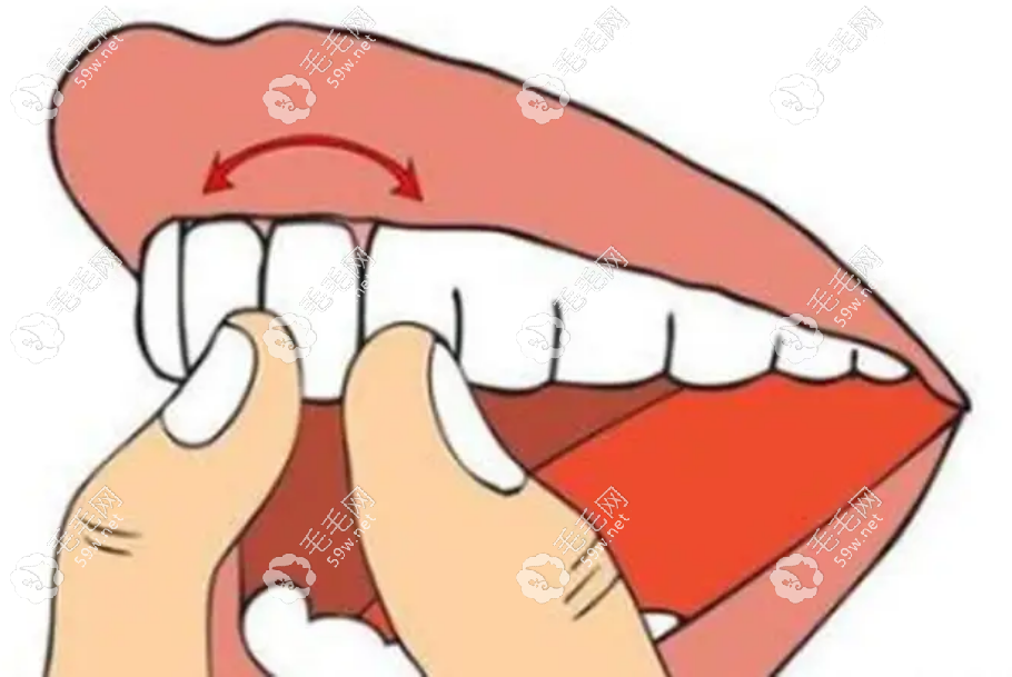成年以后千萬別整牙否則牙齒會松動