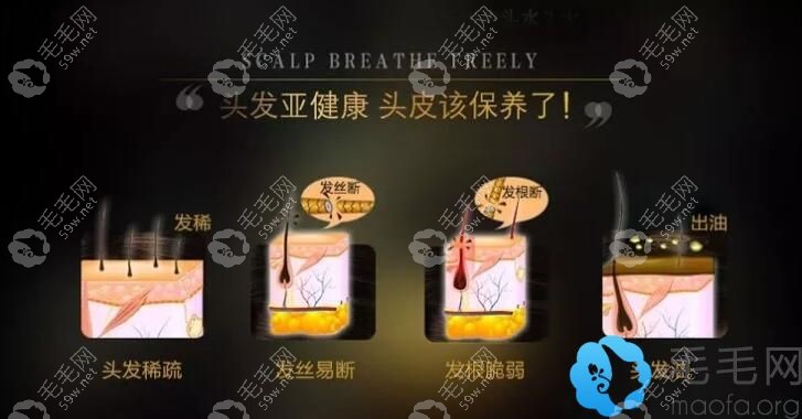 滋源生姜洗发水适应头发状况