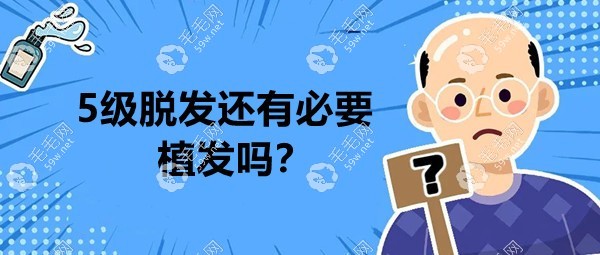 5级脱发还有必要植发吗