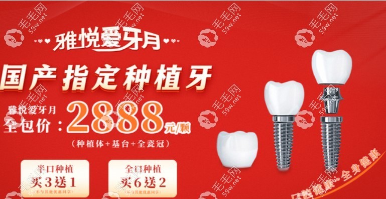 上海雅悦齿科种植牙价格表