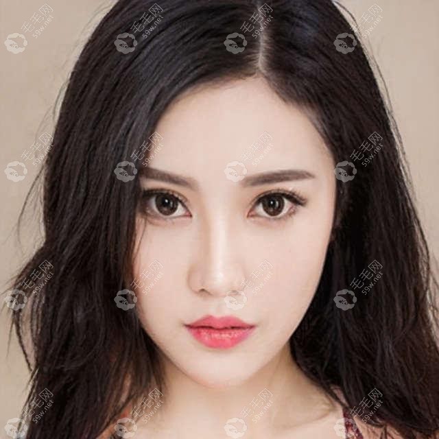网友提问:微针植发靠谱吗?种发选哪个医生比较好？