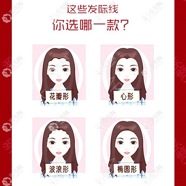 发际线的形状图片