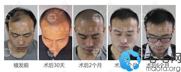 碧蓮盛植發(fā)圖