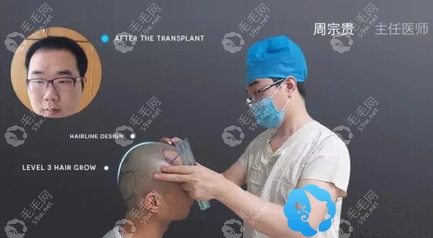 碧蓮盛植發(fā)的周宗貴醫(yī)師