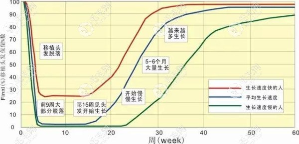 植发后头发生长过程图