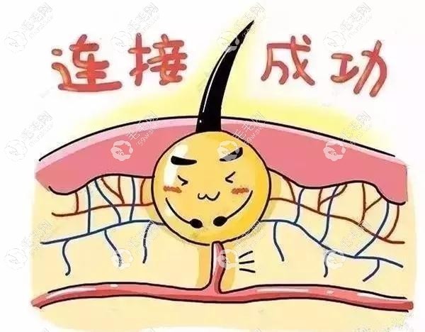新移植的毛囊一般在48小时长稳固