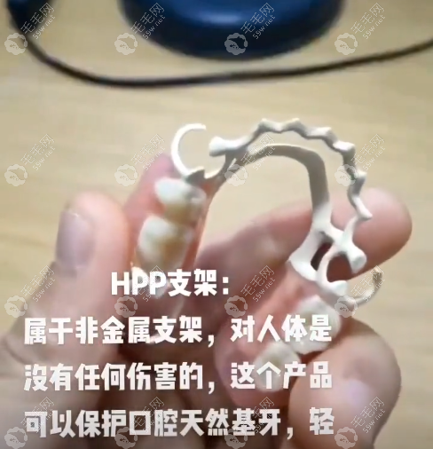 HPP粘接桥的优缺点大盘点