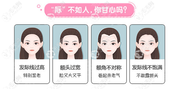 需要做发际线的的图片