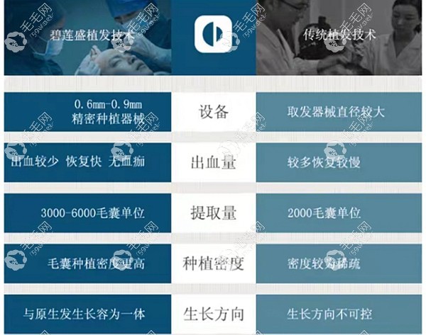 植发技术对比图分析