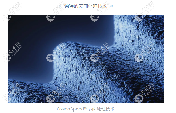 独特的表面处理技术