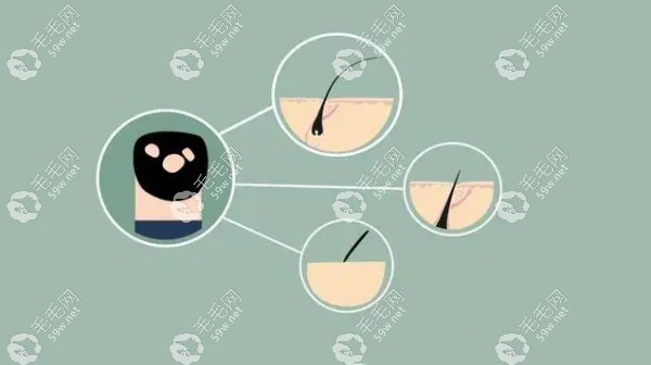 毛发需要慢慢养护