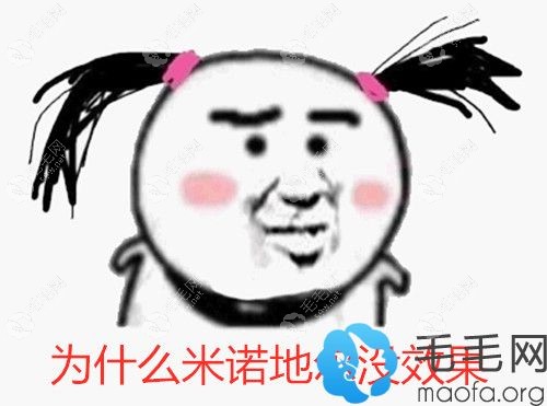 为什么用完米诺地尔没效果
