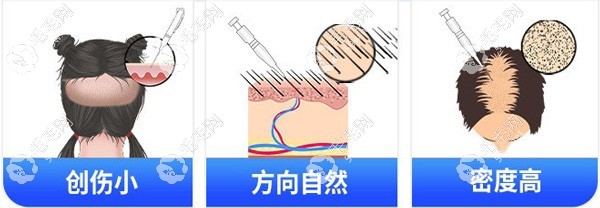 上海头发加密价格表公开www.59w.net