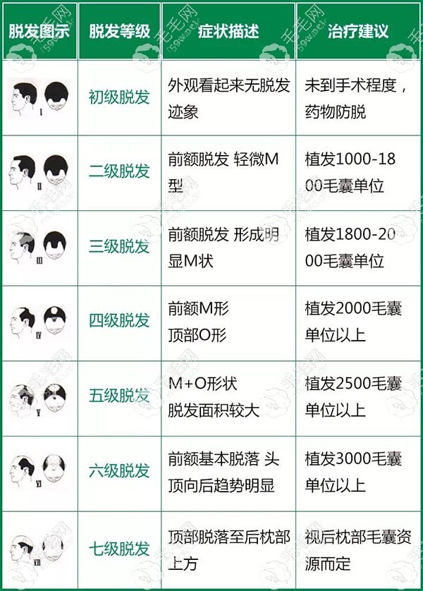 脱发等级表