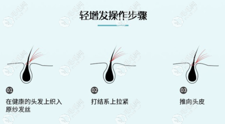 增发是要有一个绑发根的前提条件的 增发是要有一个绑发根的前提条件的