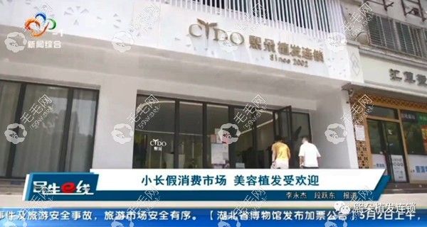 熙朵植发还被湖北新闻《民生E线》栏目报道
