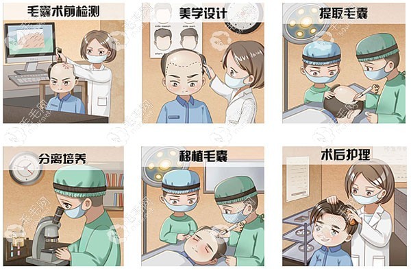 每个医院都有自己的特色植发技术