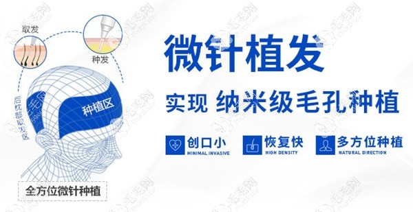 佛山大麥微針植發(fā)機構(gòu)