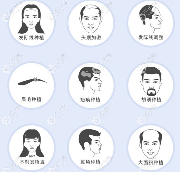 碧蓮盛植發(fā)醫(yī)院所做項目