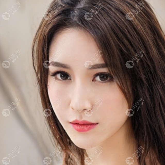 毛发移植医院感恩钜惠 找徐霞植发可抽取免单大奖