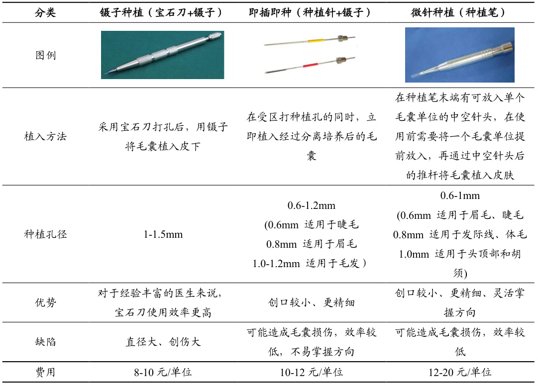 寧波亞植植發(fā)優(yōu)勢(shì)