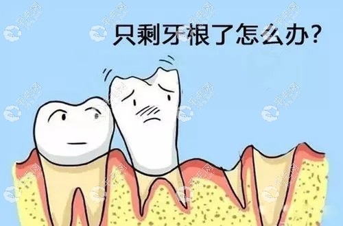 牙齒只剩殘根好多年怎么辦