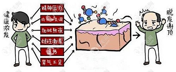 脱发原因，发友可以对照下