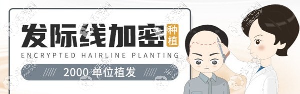 上海发际线植发2025单位
