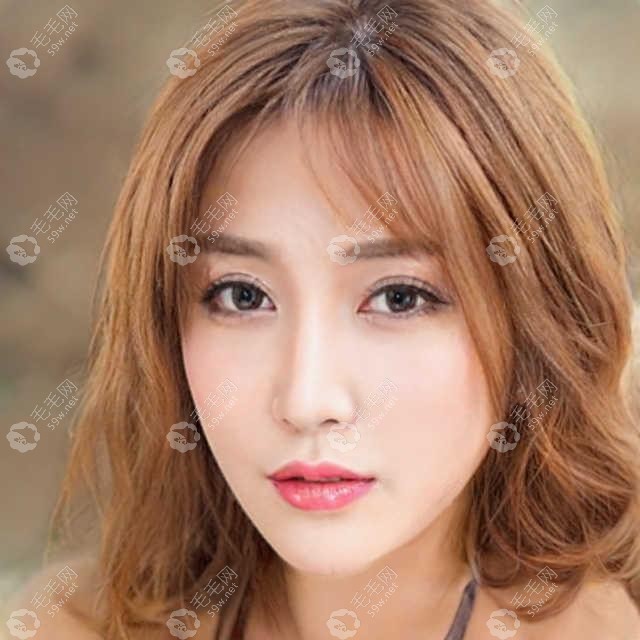 怎么确定是不是脂溢性脱发?了解特征后看看治疗方案有哪些