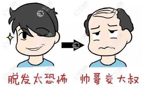 脂溢性脱发预防是关键