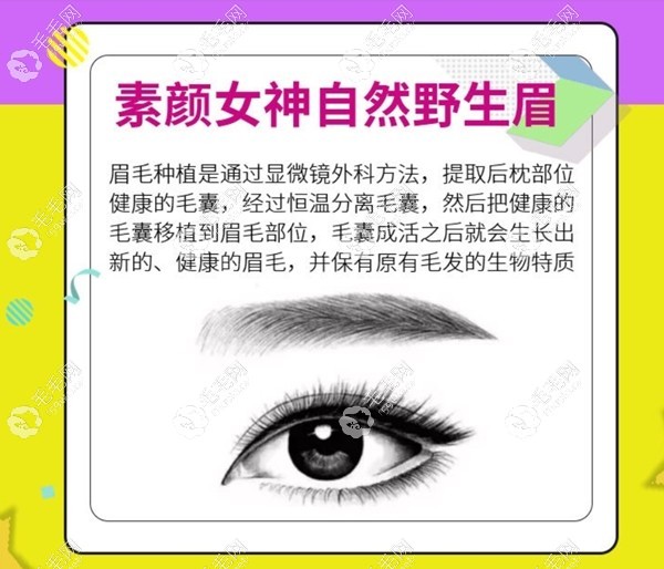 昆明王的整形种植眉毛的方法