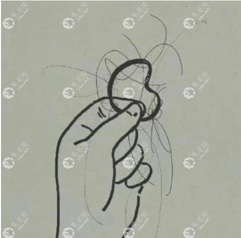 植发过后的日子难熬是真的