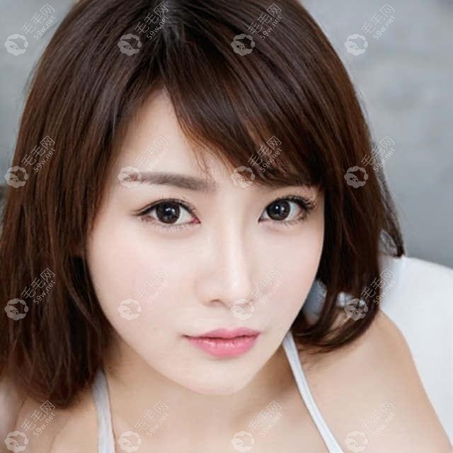 球星孔蒂植发提高颜值 欧洲杯展现意风足球