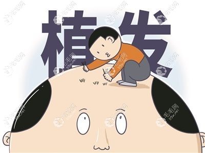 植发过后的日子真的难熬www.59w.net