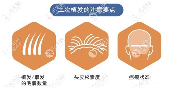 二次植发手术的注意要点