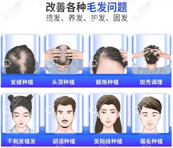 福州碧莲盛植发可以做的项目