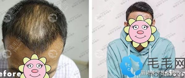 沈阳瑞丽诗植发怎么样