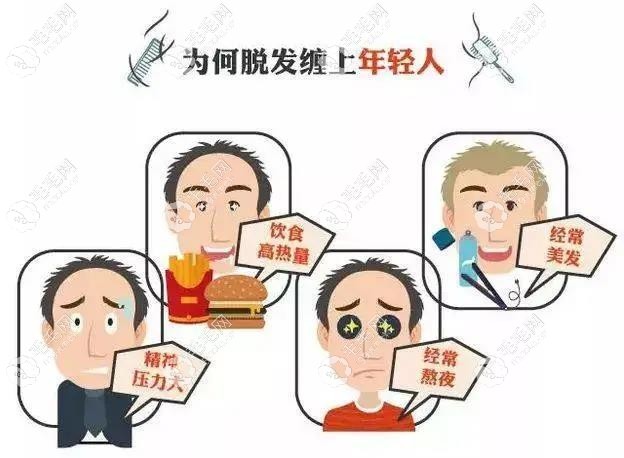 年轻人脱发原因
