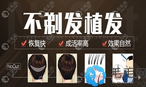 不剃发植发技术原理图