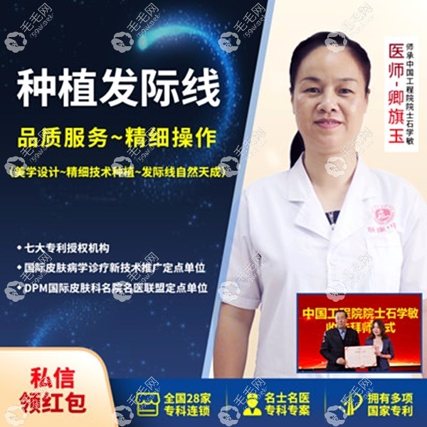 海口正规植发医院有哪几家?肤康植发不错哦